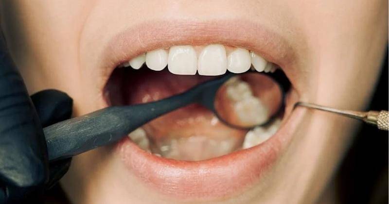 Pexels/ArvindPhilomin